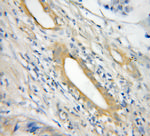 NLRP1 Antibody in Immunohistochemistry (Paraffin) (IHC (P))