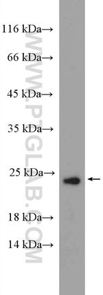 TBPL1 Antibody in Western Blot (WB)