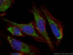 ETFA Antibody in Immunocytochemistry (ICC/IF)