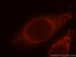 ETFA Antibody in Immunocytochemistry (ICC/IF)