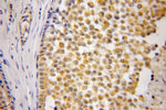 ETFA Antibody in Immunohistochemistry (Paraffin) (IHC (P))