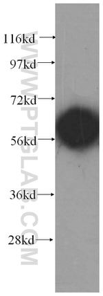 CCT8 Antibody in Western Blot (WB)