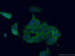 CCT8 Antibody in Immunocytochemistry (ICC/IF)