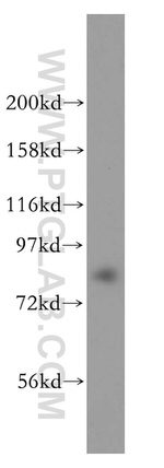 DHX15 Antibody in Western Blot (WB)