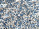 PI16 Antibody in Immunohistochemistry (Paraffin) (IHC (P))