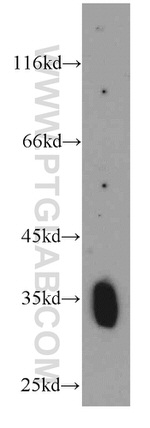 PI16 Antibody in Western Blot (WB)