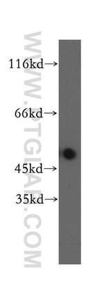 PI16 Antibody in Western Blot (WB)