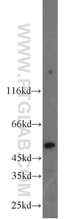 PI16 Antibody in Western Blot (WB)