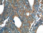 REG4 Antibody in Immunohistochemistry (Paraffin) (IHC (P))
