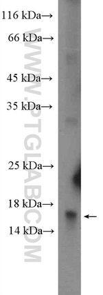 REG4 Antibody in Western Blot (WB)