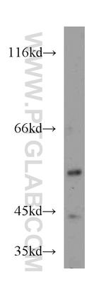 SNX7 Antibody in Western Blot (WB)