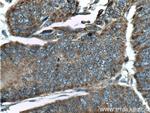 MTHFD2 Antibody in Immunohistochemistry (Paraffin) (IHC (P))