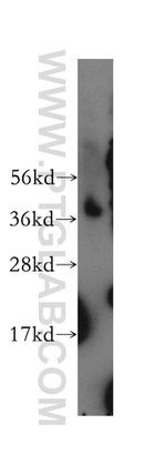MTHFD2 Antibody in Western Blot (WB)