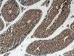 SSSCA1 Antibody in Immunohistochemistry (Paraffin) (IHC (P))