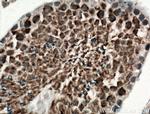 SSSCA1 Antibody in Immunohistochemistry (Paraffin) (IHC (P))