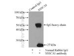 SSSCA1 Antibody in Immunoprecipitation (IP)