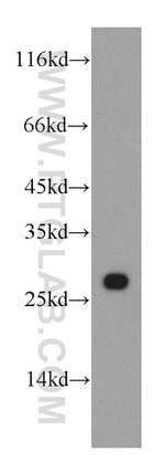 SSSCA1 Antibody in Western Blot (WB)