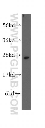 SSSCA1 Antibody in Western Blot (WB)