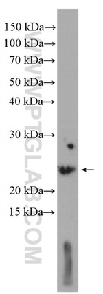 SSSCA1 Antibody in Western Blot (WB)