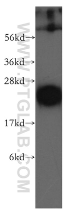 AGR2 Antibody in Western Blot (WB)