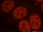 FIP1L1 Antibody in Immunocytochemistry (ICC/IF)