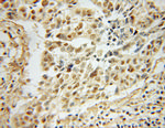 FIP1L1 Antibody in Immunohistochemistry (Paraffin) (IHC (P))