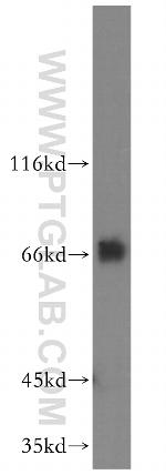 FIP1L1 Antibody in Western Blot (WB)