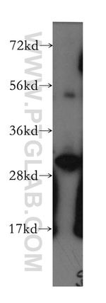 Calretinin Antibody in Western Blot (WB)