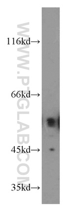 ETS2 Antibody in Western Blot (WB)