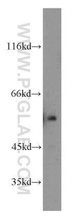 ETS2 Antibody in Western Blot (WB)