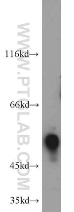ETS2 Antibody in Western Blot (WB)