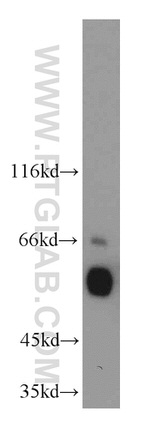 ETS2 Antibody in Western Blot (WB)