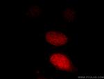 LEO1 Antibody in Immunocytochemistry (ICC/IF)