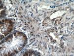 LEO1 Antibody in Immunohistochemistry (Paraffin) (IHC (P))