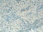 PLXDC2 Antibody in Immunohistochemistry (Paraffin) (IHC (P))