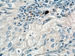 PLXDC2 Antibody in Immunohistochemistry (Paraffin) (IHC (P))