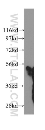 PLXDC2 Antibody in Western Blot (WB)