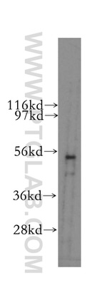 PLXDC2 Antibody in Western Blot (WB)