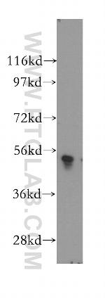 PLXDC2 Antibody in Western Blot (WB)