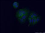 CYP4F11 Antibody in Immunocytochemistry (ICC/IF)