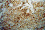 CYP4F11 Antibody in Immunohistochemistry (Paraffin) (IHC (P))