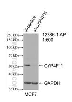CYP4F11 Antibody in Western Blot (WB)