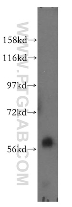 CYP4F11 Antibody in Western Blot (WB)