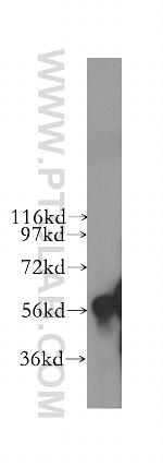 CYP4F11 Antibody in Western Blot (WB)