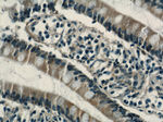 RHOF Antibody in Immunohistochemistry (Paraffin) (IHC (P))