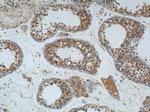 ALKBH3 Antibody in Immunohistochemistry (Paraffin) (IHC (P))