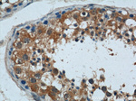 ALKBH3 Antibody in Immunohistochemistry (Paraffin) (IHC (P))