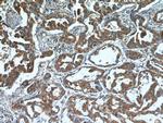 ALKBH3 Antibody in Immunohistochemistry (Paraffin) (IHC (P))