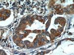 ALKBH3 Antibody in Immunohistochemistry (Paraffin) (IHC (P))