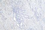 ALKBH3 Antibody in Immunohistochemistry (Paraffin) (IHC (P))